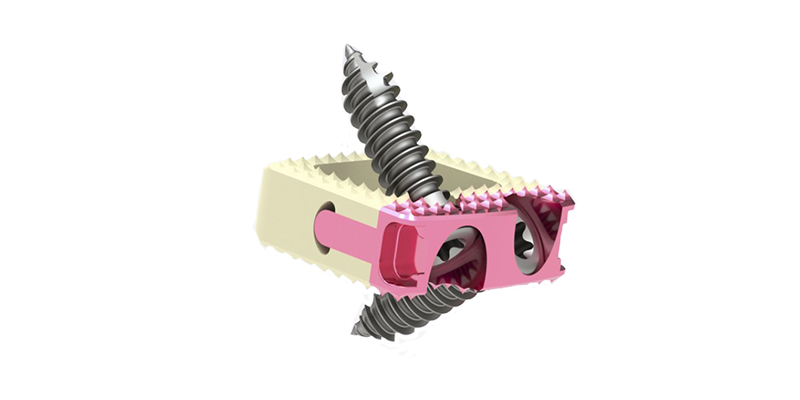 Titanopeek, cage vertebral cervical Enlife